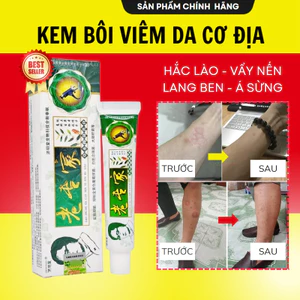 Kem Bôi Viêm Da Cơ Địa, Hắc Lào, Nấm Ngứa Đầu Chàm ,Tổ Đỉa Ghẻ Nước, Lang Ben, Á Sừng, Tuýp 15Gr
