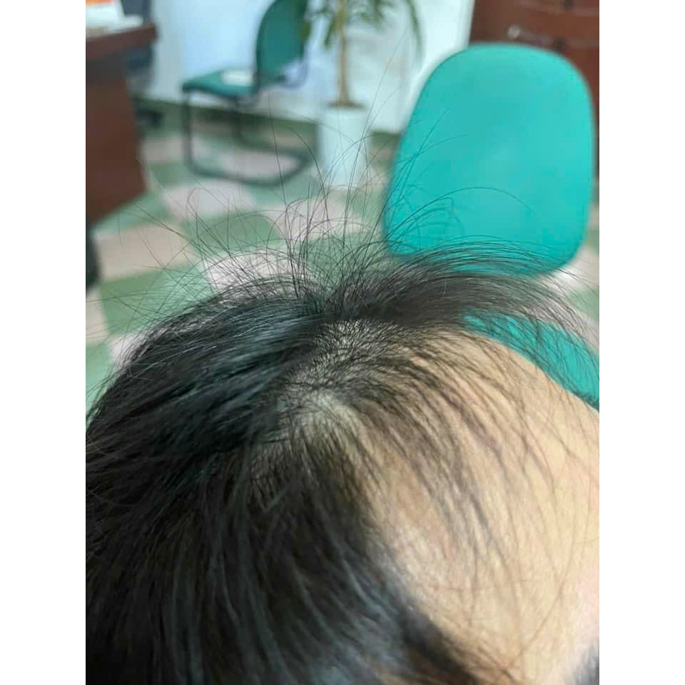 Bộ Gội Truyền Thống Xả Dưỡng Sinh chăm sóc tóc bình an
