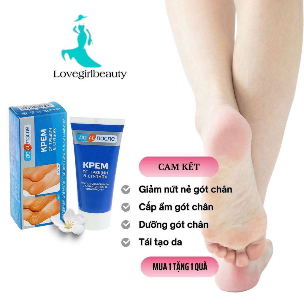 Kem Nẻ Gót Chân Before And After Foot Kpem for Cracked Feet Giảm Nẻ ...