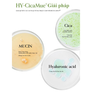 Tinh Chất Rau Má Làm Dịu Hỗ Trợ Giảm Mụn Elravie HyCicaMue Ampoule 50ml