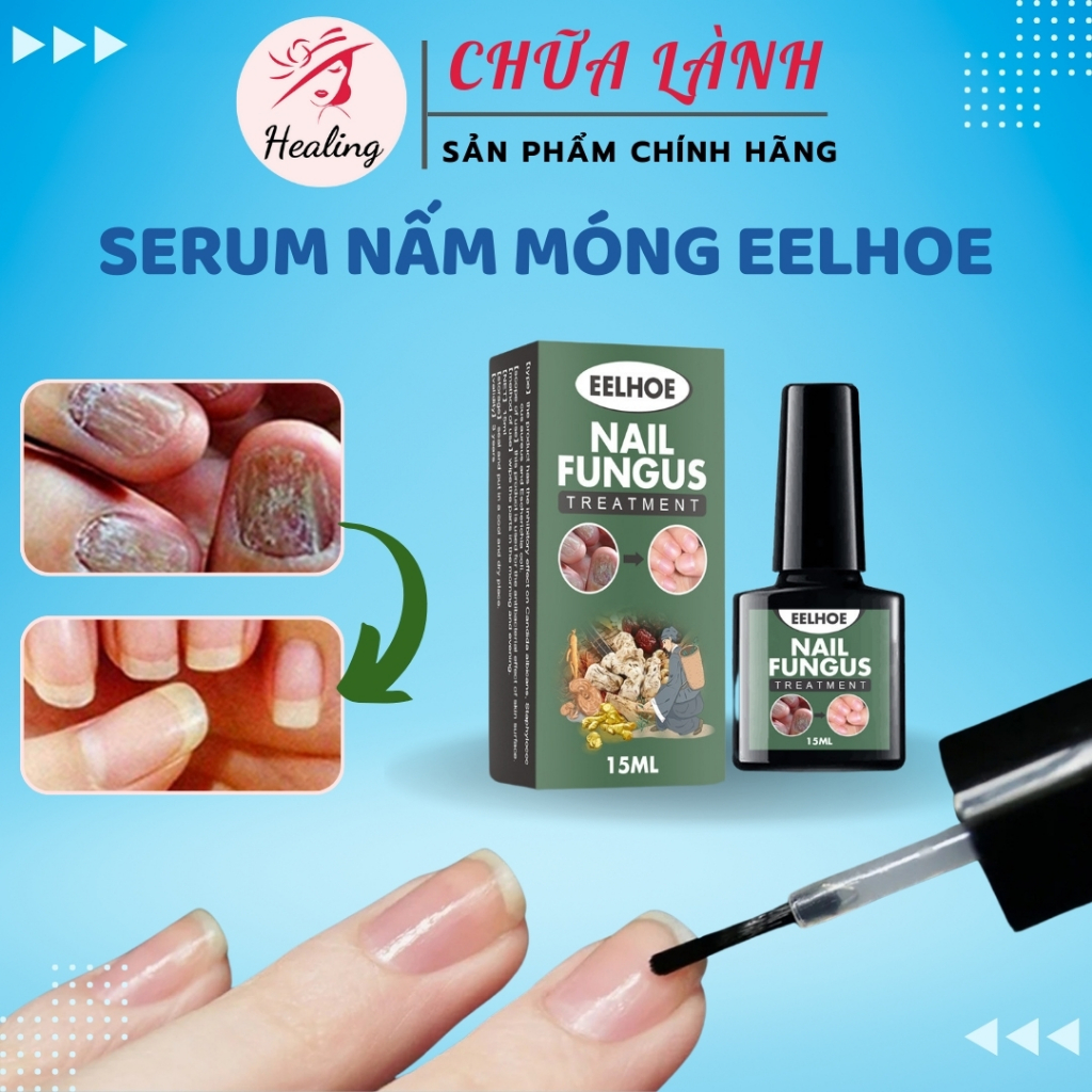 Serum nấm móng tay chân dưỡng cứng móng EELHOE 15ml hết sạch nấm bọng móng hư khoé nước H10