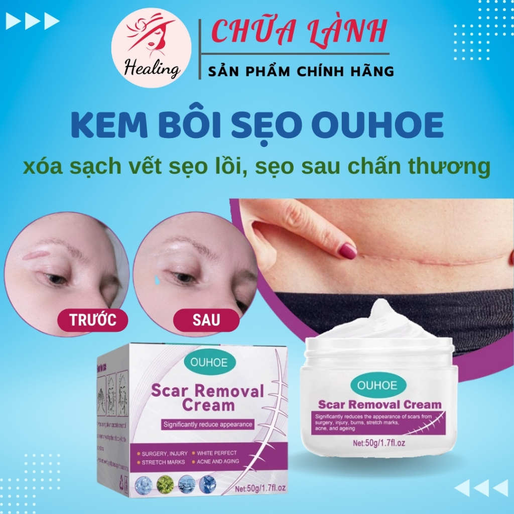 Kem bôi sẹo lồi phục hồi da bị thương OUHOE chính hãng Kem xóa mờ sẹo làm mịn da H05