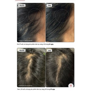 Tinh chất kích thích mọc tóc cao cấp dành cho da nhạy cảm MORPHOSIS DENSIFYING ACTIVATOR 7ML