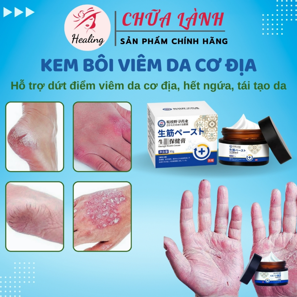 Kem viêm da cơ địa Nội địa Trung 30g hết ngứa tái tạo da Kem bôi nứt nẻ gót chân an toàn H13