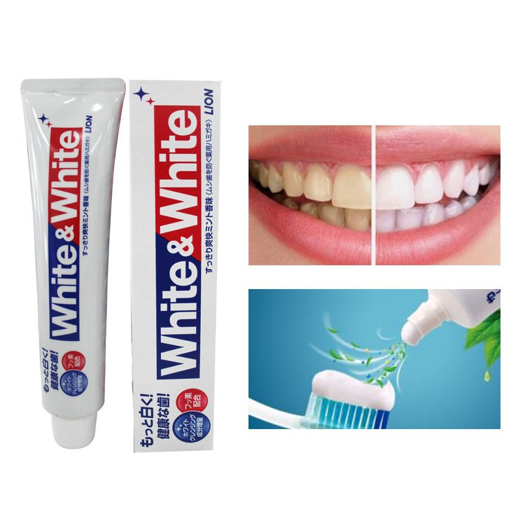 Kem Đánh Răng White & White Nhật Bản Lion 150g; Kem đánh răng siêu trắng giảm viêm nướu