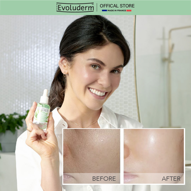 Tinh chất EVOLUDERM MOISTURIZING SERUM giúp da sáng bóng, dưỡng ẩm sâu, không bết dính 30ml.