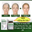 SAUSANDO glutathione niacinamide Làm trắng da nmn nhật viên nang chống lão hóa Khôi phục làn da trẻ trung