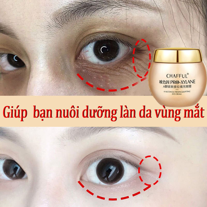 Kem Dưỡng Mắt Retinol Collagen - Hình ảnh thực tế