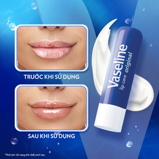 Son Dưỡng Môi Dạng Thỏi Vaseline Lip Therapy 4.8g của Hàn Quốc - CÔ THƯ MARKET