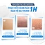Kem Dưỡng Cấp Ẩm Phục Hồi Da CeraVe Moisturising Cream Dành Cho Da Khô Nhạy Cảm Chính Hãng