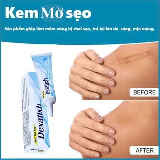 Kem mờ sẹo Dexatixh Extra hộp 1 tuýp 10g