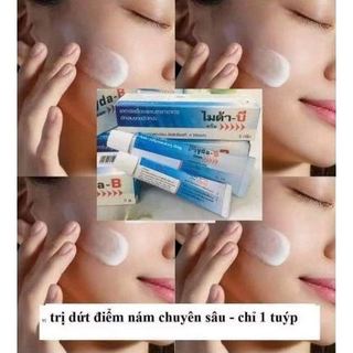 Kem bôi Nám, tàn nhang MYDA-B Thái Lan 15gr/25gr - CÔ THƯ MARKET