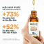 Tinh Chất Dưỡng Sáng Da Mờ Thâm Garnier Skin Naturals Bright Complete Anti-Acne Booster Serum (30ml)