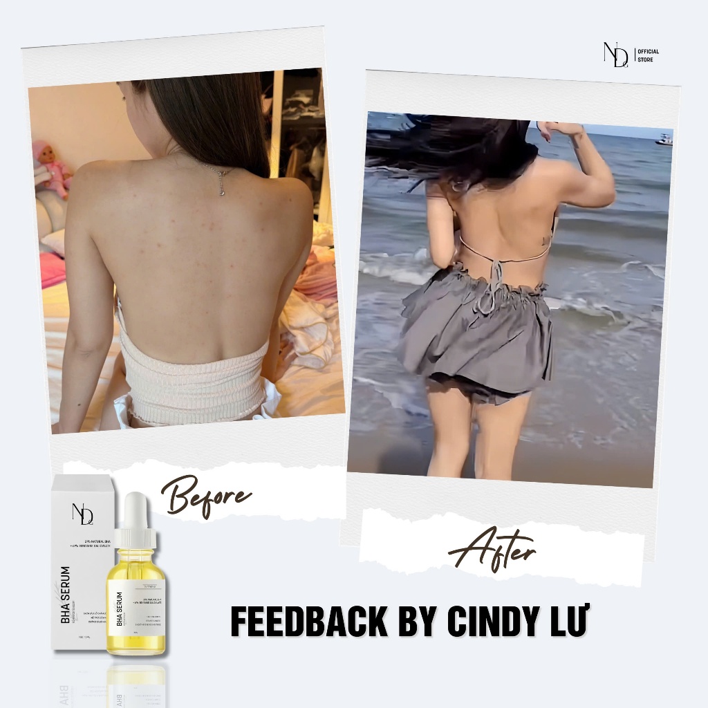 BHA Serum 8%15ml ND giảm mụn Face & Body,giảm viêm nang lông,thu nhỏ lỗ chân lông,tẩy tế bào chết,..