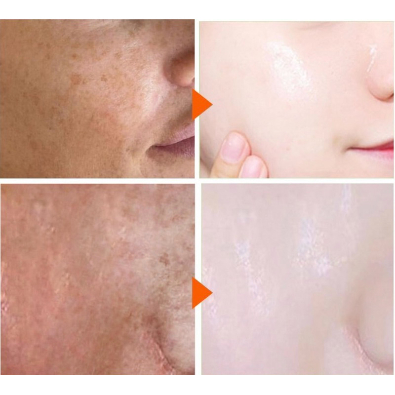 [Giao Hàng Chính Hãng ] Kem dưỡng trắng da LANTHOME Black Mushroom Glutathione Cream Multi-Care Freckle Cream