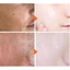 Kem dưỡng trắng da LANTHOME Black Mushroom Glutathione Cream Multi-Care Freckle Cream