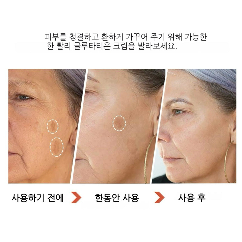 [Giao Hàng Chính Hãng ] Kem dưỡng trắng da LANTHOME Black Mushroom Glutathione Cream Multi-Care Freckle Cream