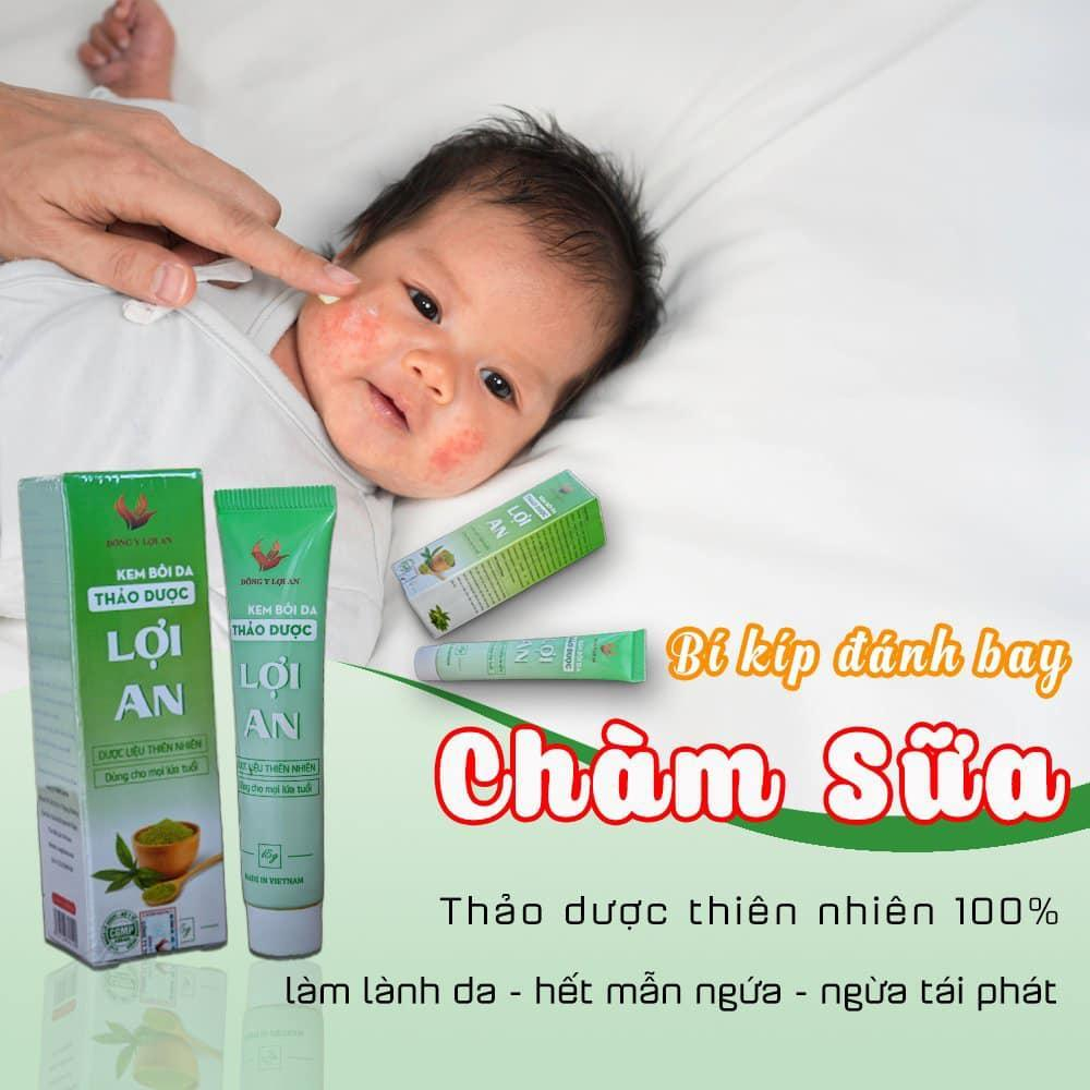 Ảnh Kem Bôi Da Lợi An Cho Bé Chính Hãng - Hỗ Trợ Hăm Tả, Chàm Sữa, Rôm Sảy , Mẫn Ngứa cho bé sơ sinh 1