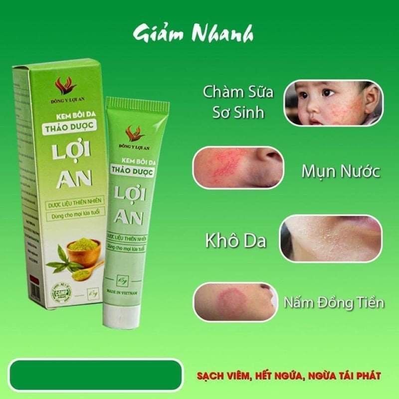 Ảnh Tinh Dầu Lợi An và Kem Bôi Da Lợi An Chính Hãng 2