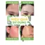 Serum làm dịu da giảm kích ứng ANUA Azelaic Acid 10 Hyaluron Redness Soothing Serum 30ml [Glow Beauty]