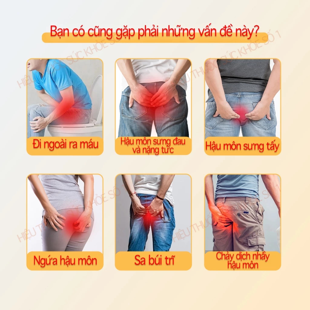 Kem bôi trĩ, giảm sưng đau vùng hậu môn, tiêu sưng,cầm máu và làm co búi trĩ (dùng cho cả nam và nữ)