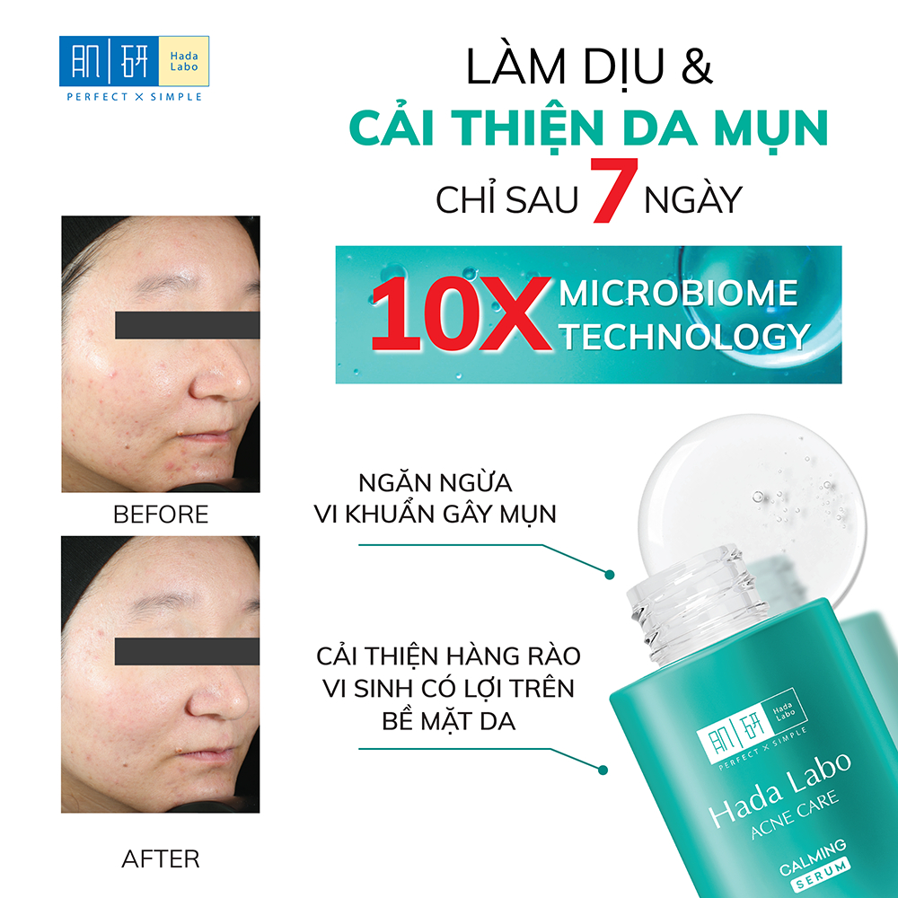 Ảnh Serum dưỡng ẩm cho da mụn, nhạy cảm Hada Labo Acne Care Calming Serum 30ml 4