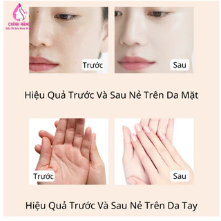 Combo 5 lọ Kem Hương Đào Hết Nứt Nẻ Da Chân Tay Miệng Dưỡng Ẩm Mịn Ngay Sau Khi Thoa 20g