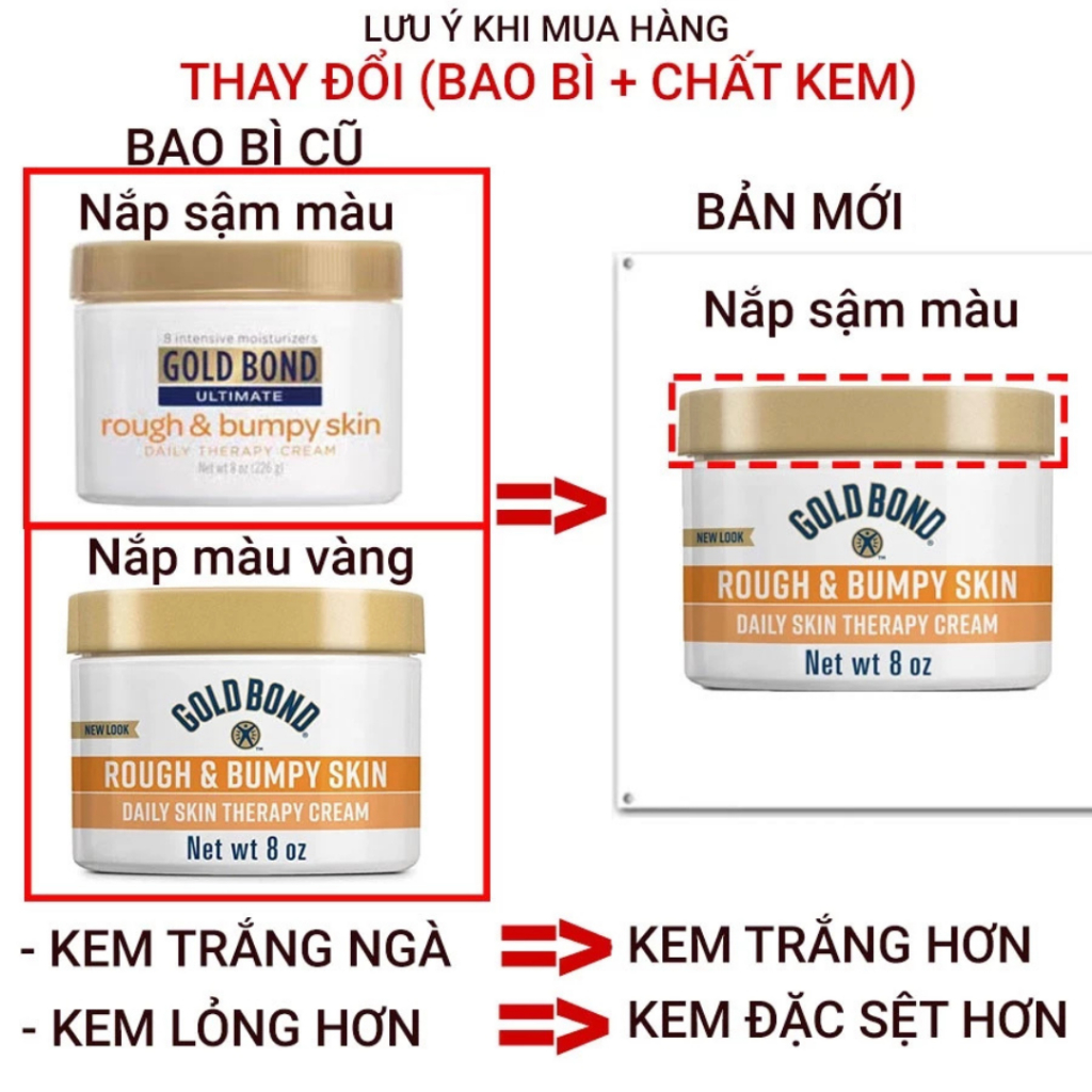 Kem dưỡng Body GOLD BOND ULTIMATE ROUGH BUMPY SKIN giảm thâm, sần mông chính hãng, của Mỹ