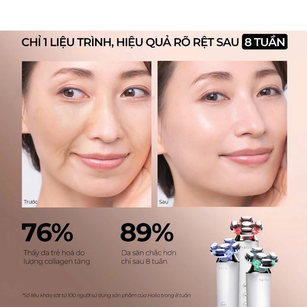 Máy nâng cơ, giảm mỡ mặt & trẻ hoá da kết hợp ánh sáng sinh học Halio RevitaWave Skin Rejuvenator