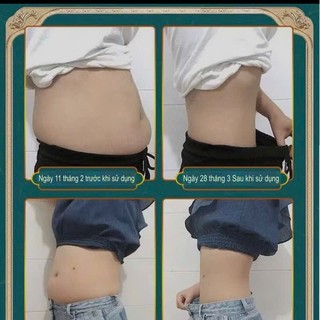 Miếng Dán Đốt Mỡ Siết Eo Đồng Nhân Đường, Miếng Dán Giảm Đau Nhức, Tinh Dầu Ngải Cứu, Mặt Nạ Thảo Mộc, Vân Thỏ Beauty