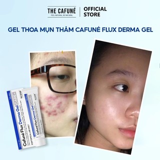 Gel chấm Mụn Thâm Cafuné Flux Derma Essence Cafuné Giảm Mụn Mờ Thâm Ngừa Mụn Cho Mọi Loại Da