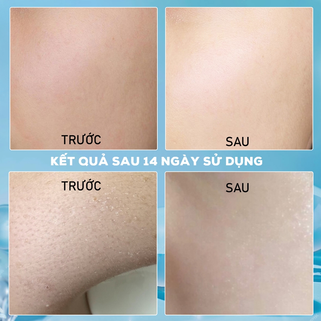 Chất lượng Sản Phẩm Serum Phục Hồi Chống Lão Hóa