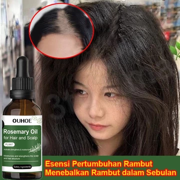 serum mọc tóc tinh chất chống rụng tóc 50ml tinh chất mọc tóc tóc dày kích thích tóc mọc dà hói đầu sau sinh