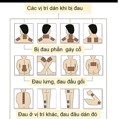 Đĩa Tiêu Chuẩn - Thoát vị đĩa đệm