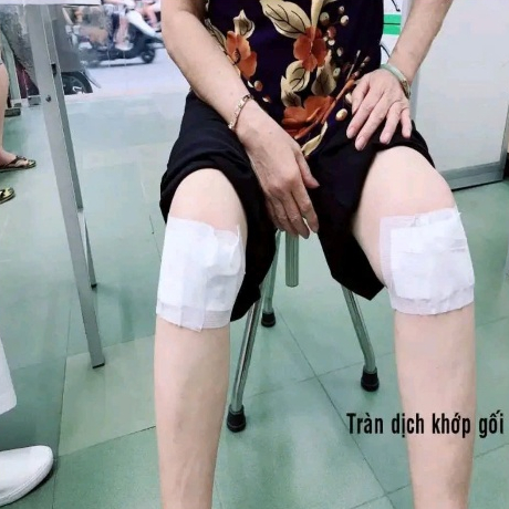 Cao dán Thoái Cốt Hoàn dùng giảm đau xương khớp, đau cổ vai gáy, đau lưng, đau thoát vị đĩa đệm - 1 Hộp 10 miếng