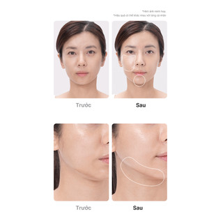 Thiết bị làm đẹp MEDICUBE Age-R Booster Pro/Pro 2