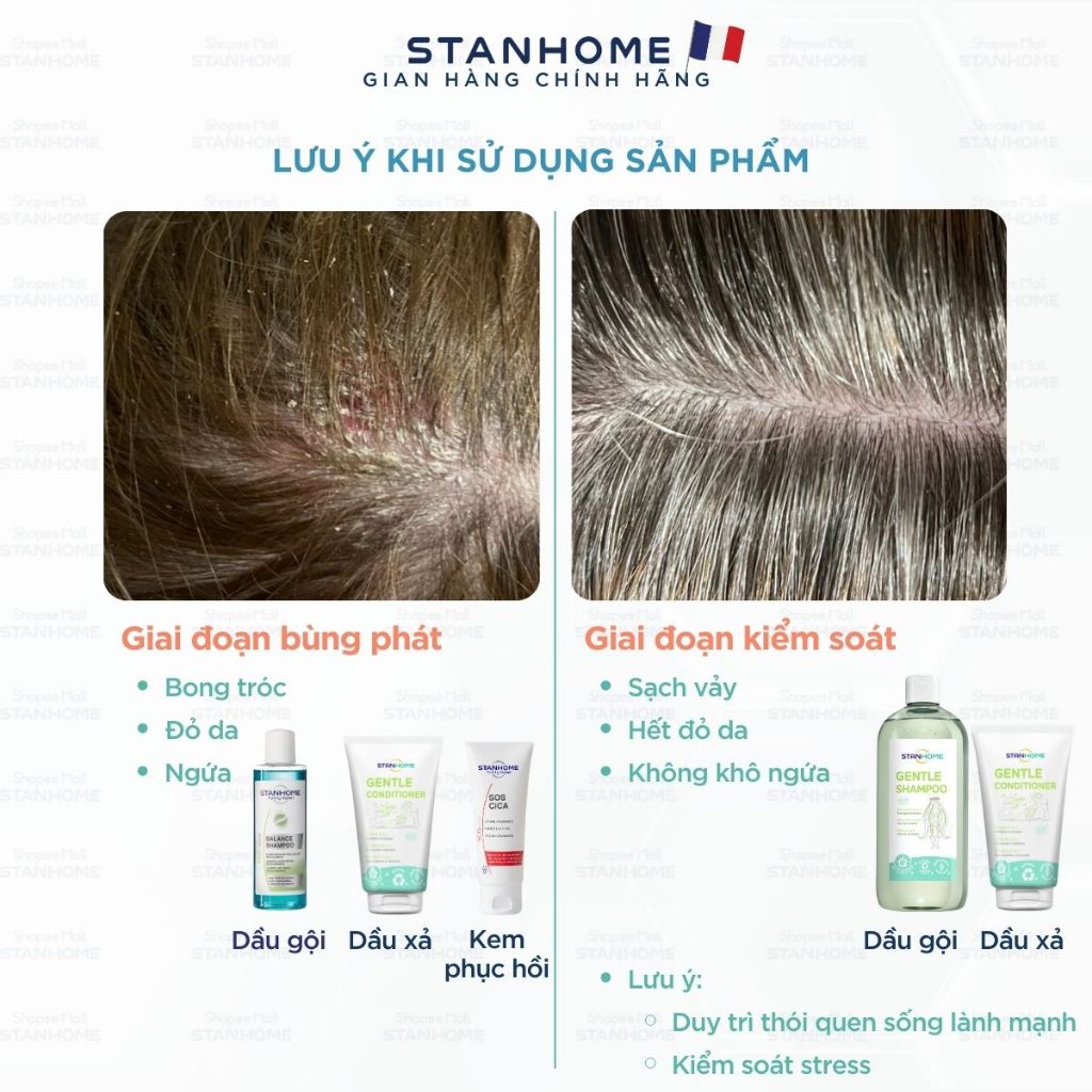 Ảnh Combo viêm da đầu tiết bã Stanhome Balance Shampoo-Sos Cica-Gentle shampoo - Gentle Conditioner 2