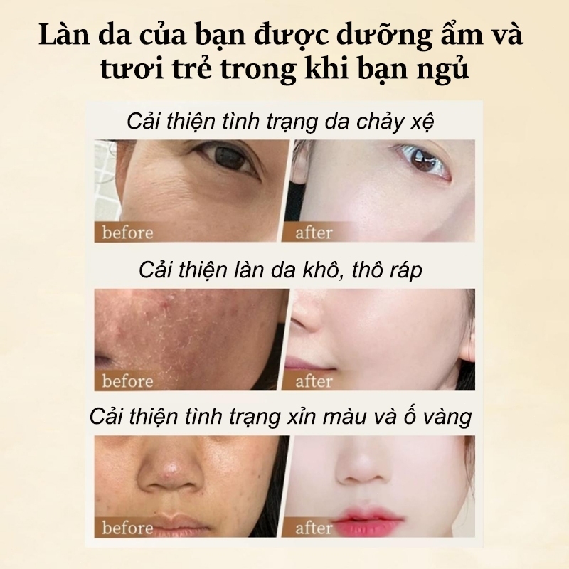 Mặt nạ ngủ Mặt nạ thạch collagen Mặt nạ làm trắng Dưỡng ẩm Chống nhăn Thu nhỏ lỗ chân lông 4ml*20pcs