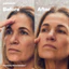Kem Microshots™ AgeDefying Peptide⁶ trẻ hoá,nâng cơ da mặt Justhuman
