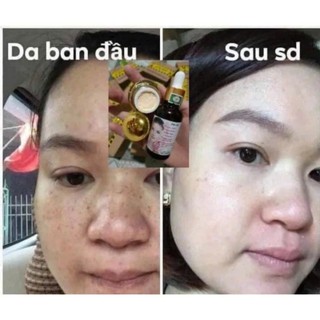 Combo Sỉ 20 Cặp Kem Face Tái Tạo Da Gia Truyền Mờ Nám Tàn Nhang