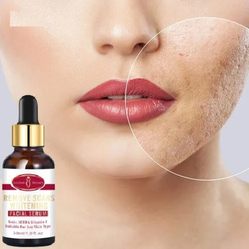 Serum Hết Sẹo Thâm Sẹo Rỗ, Sẹo Lỗ Chân Lông To, Sẹo Côn Trùng Cắn Chuyên Biệt Để ức Chế Hoặc Tăng Sinh Collagen