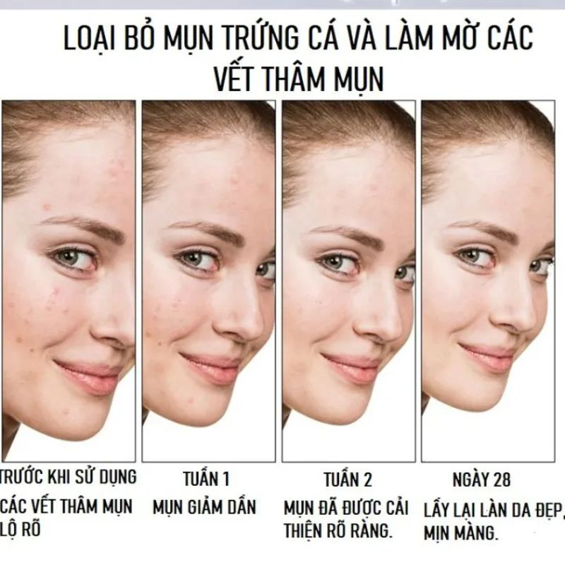 Serum Hết Sẹo Thâm Sẹo Rỗ, Sẹo Lỗ Chân Lông To, Sẹo Côn Trùng Cắn Chuyên Biệt Để ức Chế Hoặc Tăng Sinh Collagen