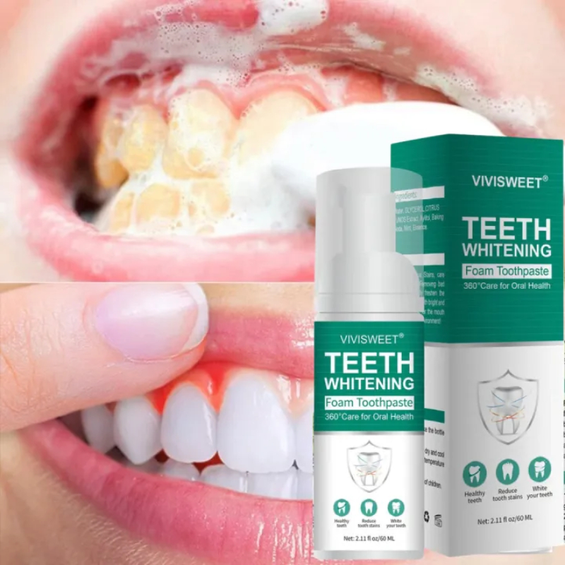 Xịt Đánh Răng Tạo Bọt Teeth Whitening Vivisweet Làm Trắng Răng, Ngăn Ngừa Sâu Răng, Loại Bỏ Mảng Bám, Khử Mùi Hôi, Mang