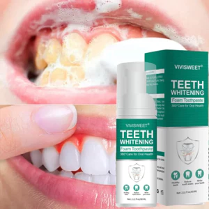 Xịt Đánh Răng Tạo Bọt Teeth Whitening Vivisweet Làm Trắng Răng, Ngăn Ngừa Sâu Răng, Loại Bỏ Mảng Bám, Khử Mùi Hôi, Mang