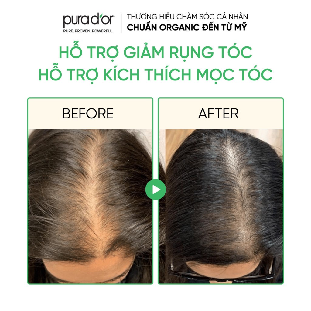 Ảnh Tinh chất hữu cơ hỗ trợ mọc tóc, dày tóc Pura D'or Hair Therapy Energizing Scalp Serum 120ml 4