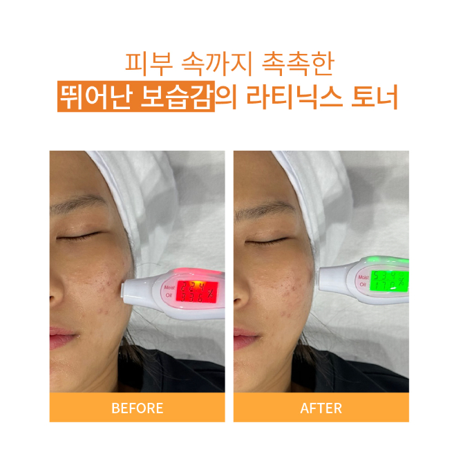 Ảnh Toner Vitamin C Phục Hồi Nâng Tông Làm Trắng Da Lateenix Toner 100ml 4
