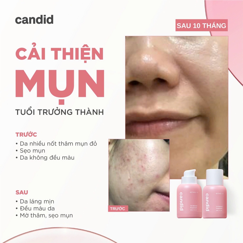 Tinh Chất Chống Lão Hóa Candid Retinol Bọc Vi Nang Hàn Quốc 30ml