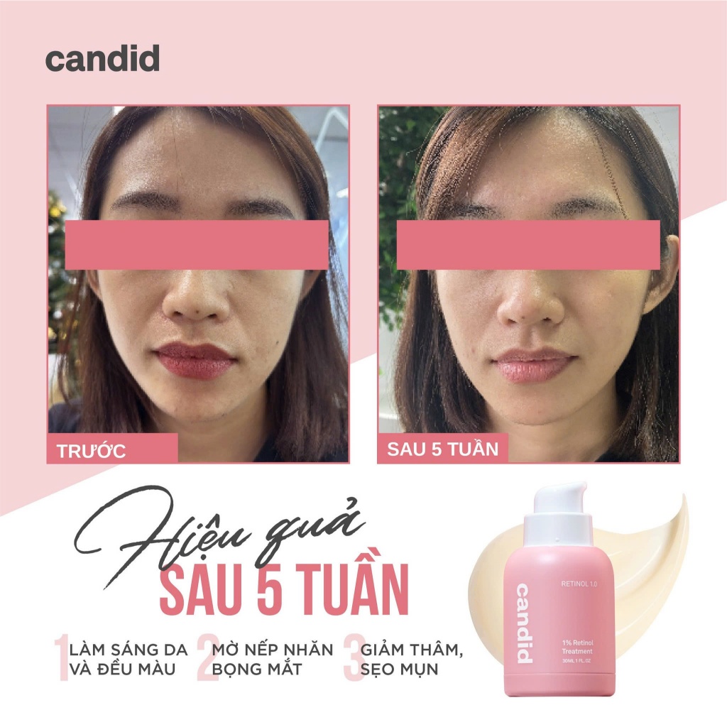 Tinh Chất Chống Lão Hóa Candid Retinol Bọc Vi Nang Hàn Quốc 30ml