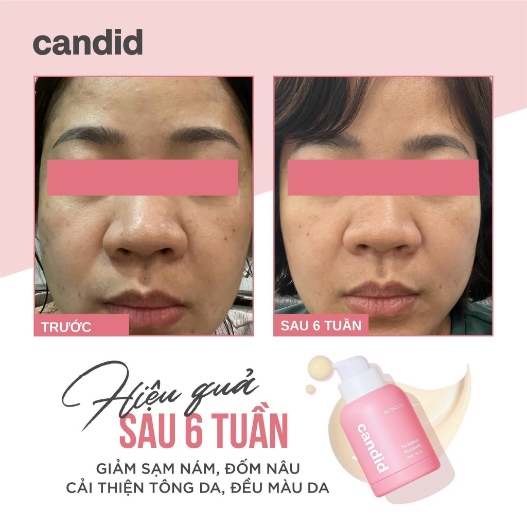 Tinh Chất Chống Lão Hóa Candid Retinol Bọc Vi Nang Hàn Quốc 30ml