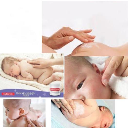 Kem hăm tã Sudocrem